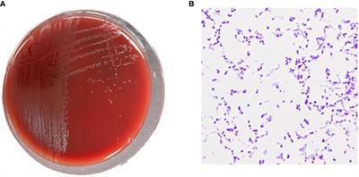 A rare bacteremia caused by Fannyhessea vaginae in a pregnant woman: case report and literature review